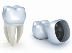 Зубные коронки - протезирование в Германии